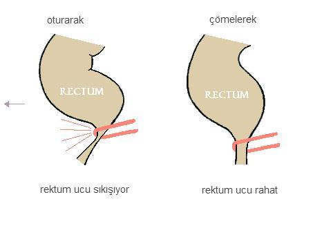 Tuvalette Doğru Oturmanın Önemini Biliyor muydunuz?