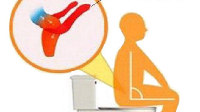 Tuvalette Doğru Oturmanın Önemini Biliyor muydunuz?