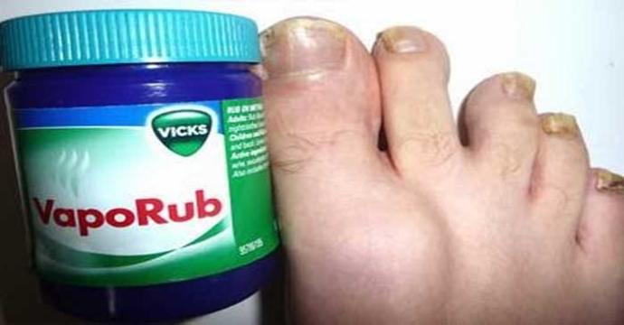 Soğuk Algınlığınız Olmasa Bile Vicks İle Yapabileceğiniz Şaşırtıcı Şeyler!