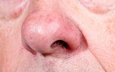 Vücuttaki Tüyleri Sevmek İçin Nedenler