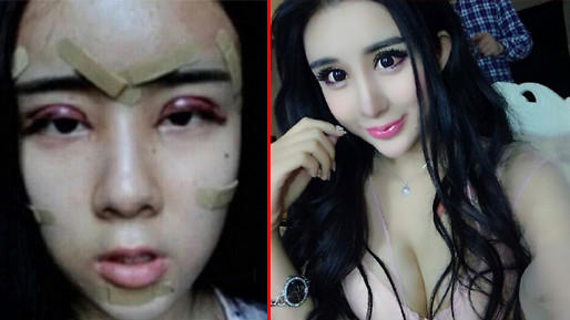 15 Yaşında Sevgili Tarafından Terk Edilen Lee Hee Danae'nin Sevgilisini Kazanma Yöntemi