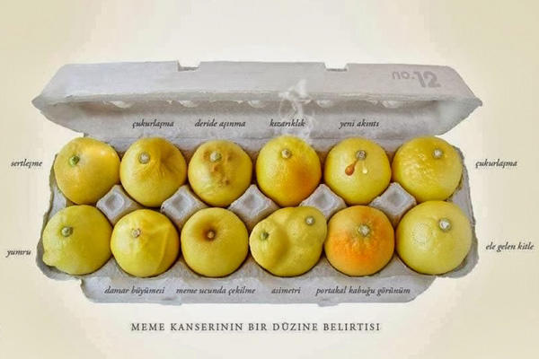 Erkeklerde Meme Kanseri Olur mu?