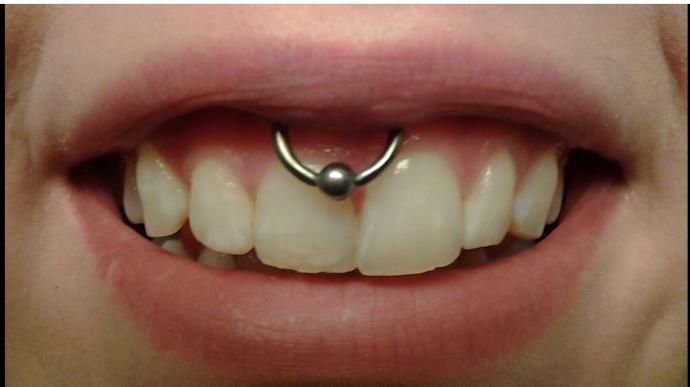 En İlginç ve Asla Yaptırmak İstemeyeceğiniz Piercing Modelleri
