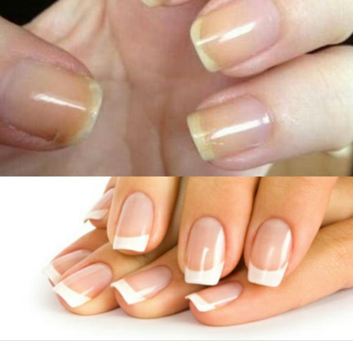 Daha Temiz Ve Güçlü Tırnaklar İçin Önerilerim💅