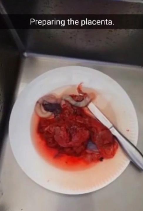 Vücudunu Daha Çok Geliştirmek Umuduyla Yeni Doğan Kızının Plasentasını Yiyen Adam