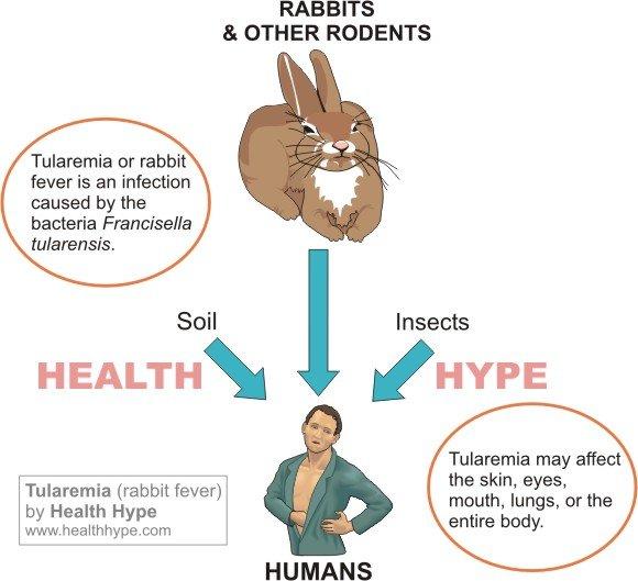 Tularemi Nedir? Belirtileri Nelerdir?