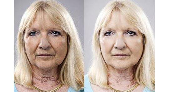 Pahalı Anti-Aging Kremlerini Bir Kenara Bırakın; Kendi Maskenizi Kendiniz Yapın!