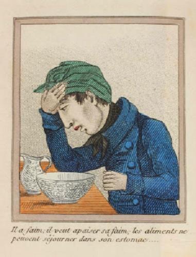 1830 Yılında Yaşayan ve Mastürbasyon Yüzünden Acı ve Izdırap Dolu Bir Son Yaşayan İbretlik Bir Gencin Hikayesi