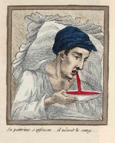 1830 Yılında Yaşayan ve Mastürbasyon Yüzünden Acı ve Izdırap Dolu Bir Son Yaşayan İbretlik Bir Gencin Hikayesi