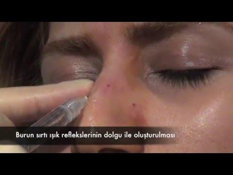 Güzelleşmek İçin Yapılan Yüz Dolguları