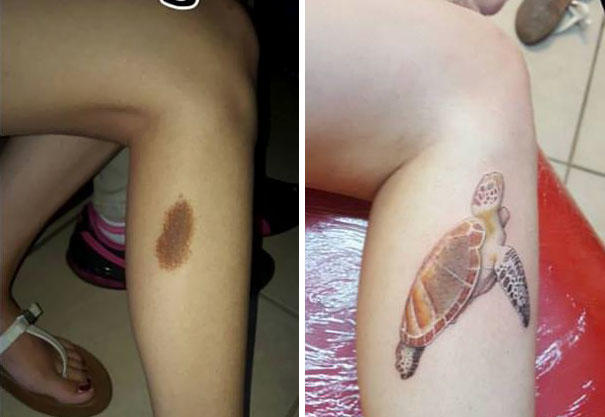Doğum Lekelerinin Sizi Yansıtacak Dövmelere Dönüşümü