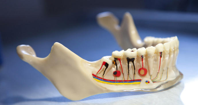 Kanal Tedavisi: Endodonti