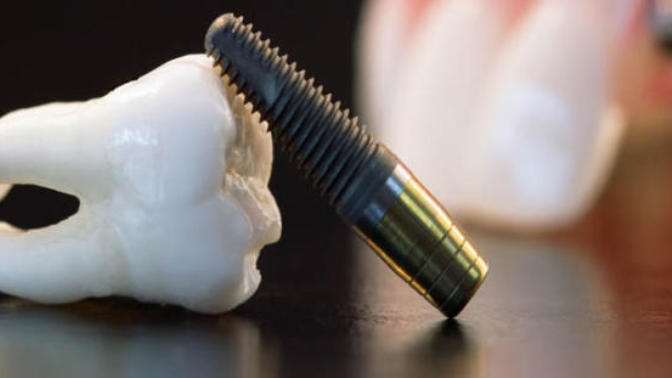 Kanal Tedavisi: Endodonti