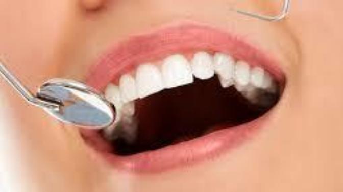 Diş Eti Hastalıkları: Periodontoloji