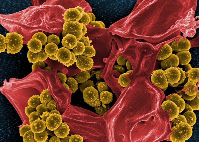 Bakteriler Antibiyotiklere Karşı Direnç Kazandı! İşte Süper Bakteriler!
