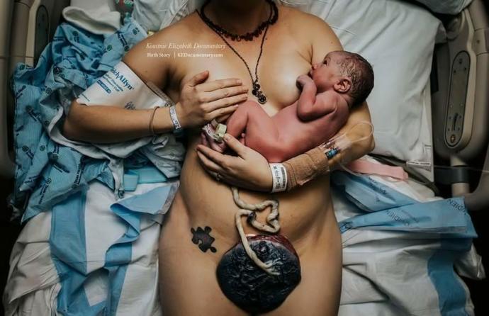 Anne Olmanın Güçlüğü Temalı 2017 Doğum Fotoğrafları Yarışması