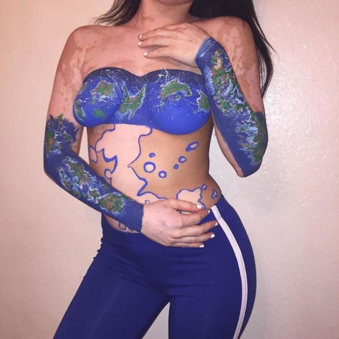 Vitiligo Olduğu İçin Ömrü Boyunca Zorbalık Gören Kız Vücudunu Sanat Eserine Dönüştürdü