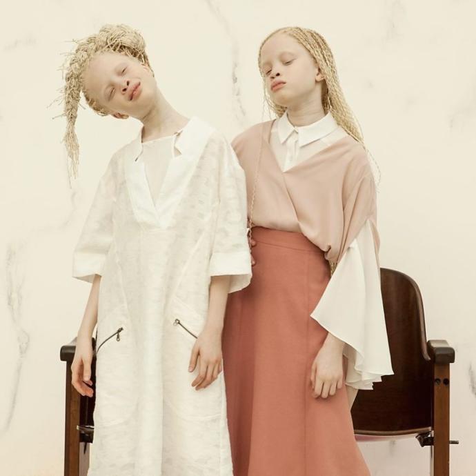 Onlar Bildiğiniz Gibi Değil, Onlar Çok Farklı: İkiz Albino Modeller!