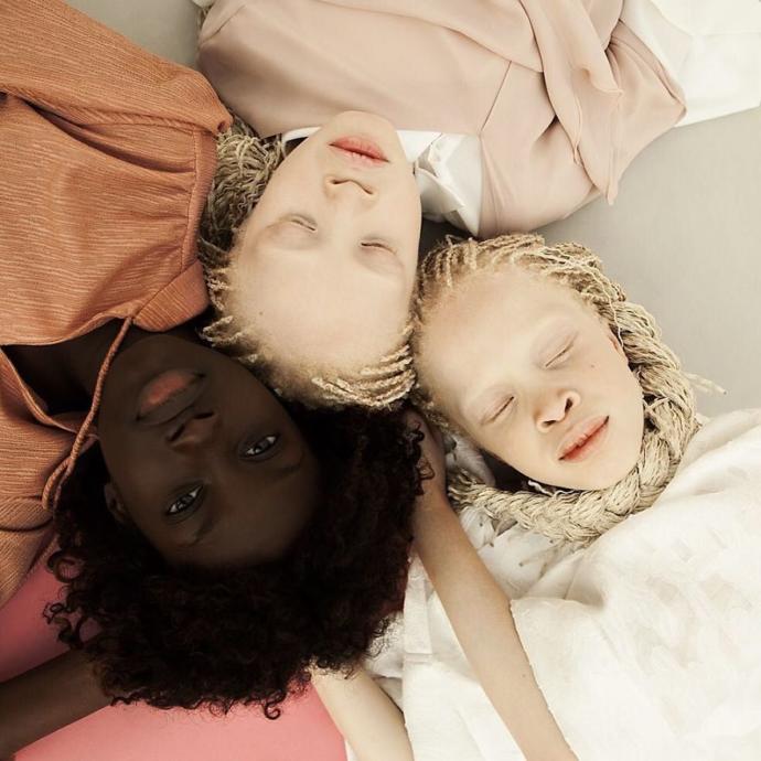 Onlar Bildiğiniz Gibi Değil, Onlar Çok Farklı: İkiz Albino Modeller!