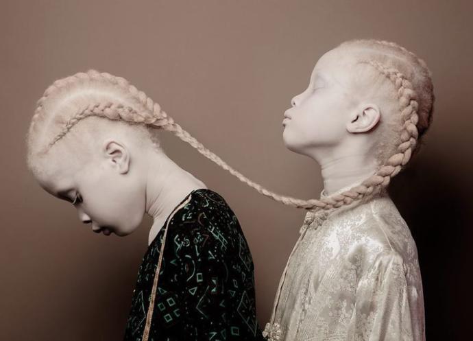Onlar Bildiğiniz Gibi Değil, Onlar Çok Farklı: İkiz Albino Modeller!