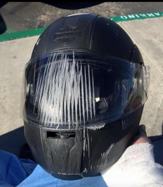 Kask Kullanmanız İçin Sizi Anında İkna Edecek Kazalar