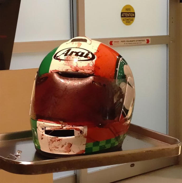 Kask Kullanmanız İçin Sizi Anında İkna Edecek Kazalar
