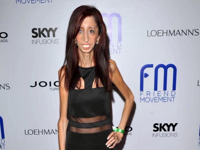 Öz Güveni ve Cesaretiyle Herkese Örnek Olan Kadın: Lizzie Velasquez