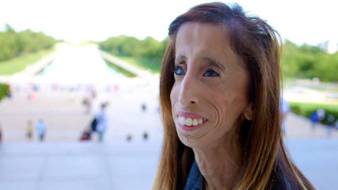 Öz Güveni ve Cesaretiyle Herkese Örnek Olan Kadın: Lizzie Velasquez