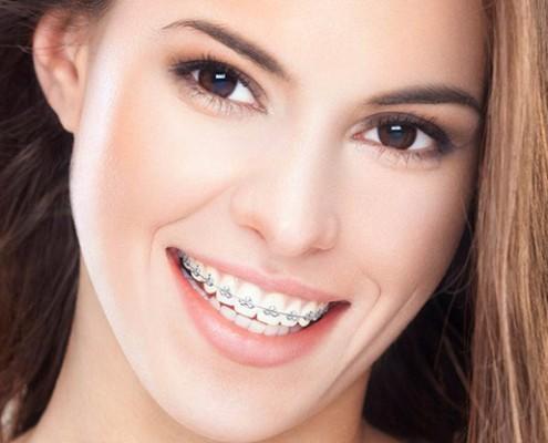 Toplum Tarafından "Kusur" ve "Çirkinlik" Olarak Adlandırılan 5 Çekici Şey!