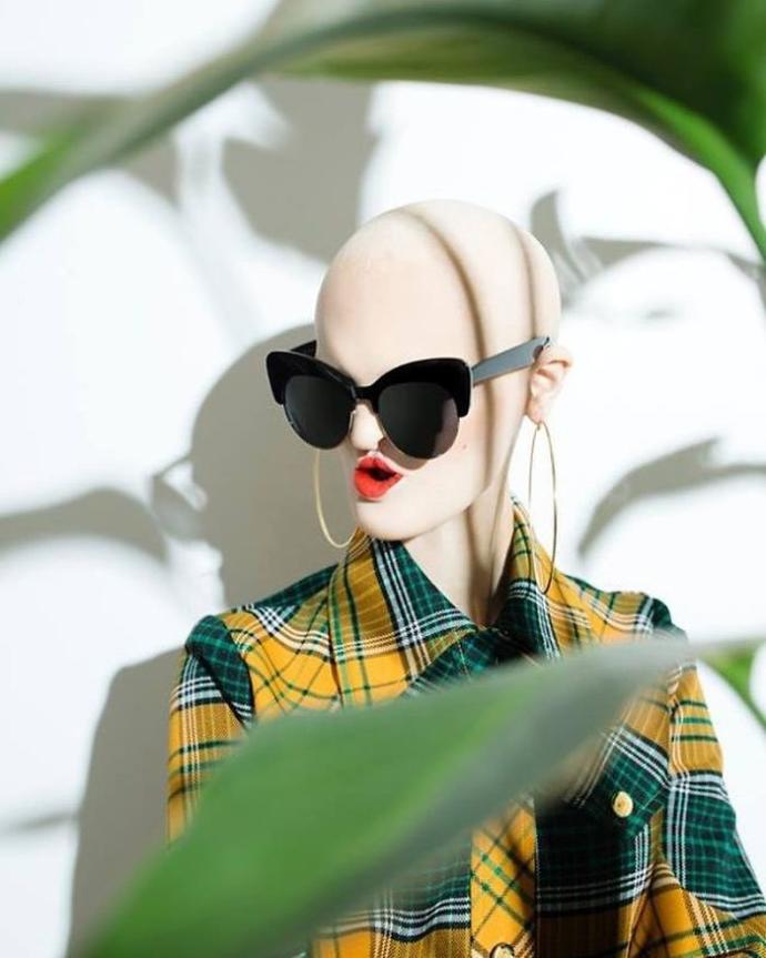 Sahip Olduğu Genetik Bozukluğa Rağmen Moda Dünyasını Sarsan Cesur Kadın