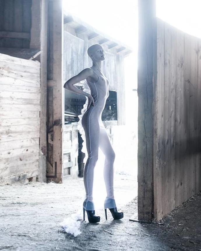Sahip Olduğu Genetik Bozukluğa Rağmen Moda Dünyasını Sarsan Cesur Kadın