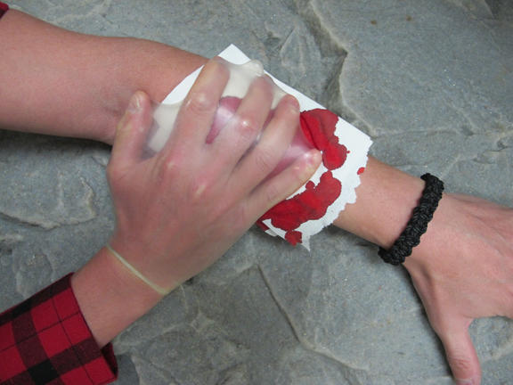 Hayat Kurtaran Prezervatif ile Bir Survivor Hikayesi