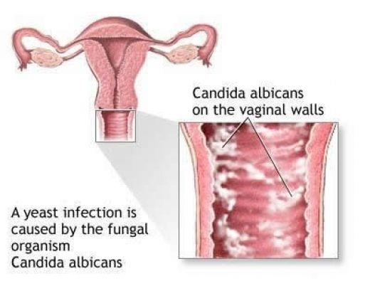 Kadınların Genital Hastalıklardan Korunmasına Yardımcı Olacak 8 Sağlık Tüyosu!