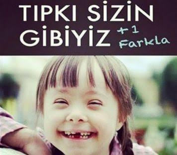 Baldan Tatlı Down Sendromlu İnsanlar!