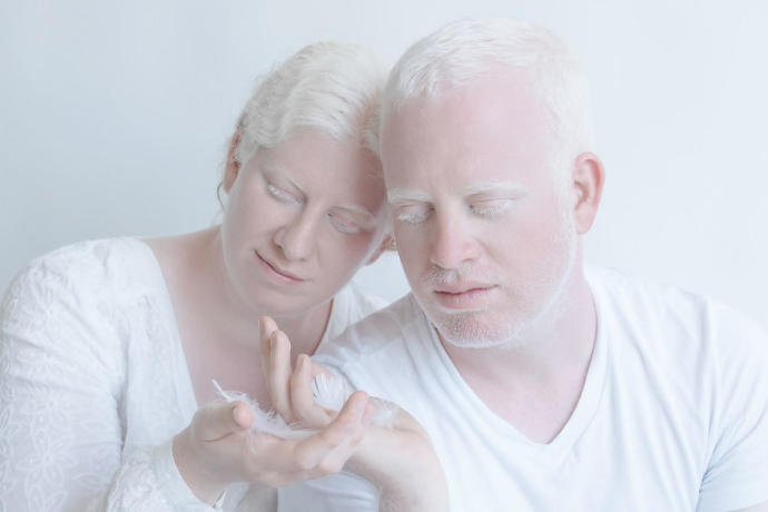 Farklılıkların Eşsiz Olduğunu İspat Eden Albino Modeller