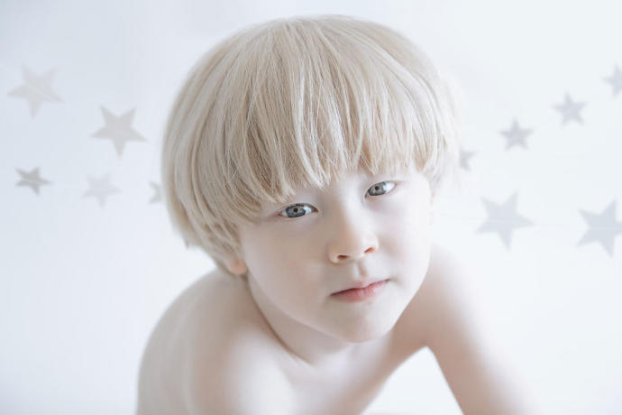 Farklılıkların Eşsiz Olduğunu İspat Eden Albino Modeller
