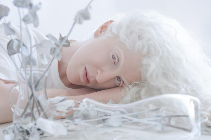 Farklılıkların Eşsiz Olduğunu İspat Eden Albino Modeller