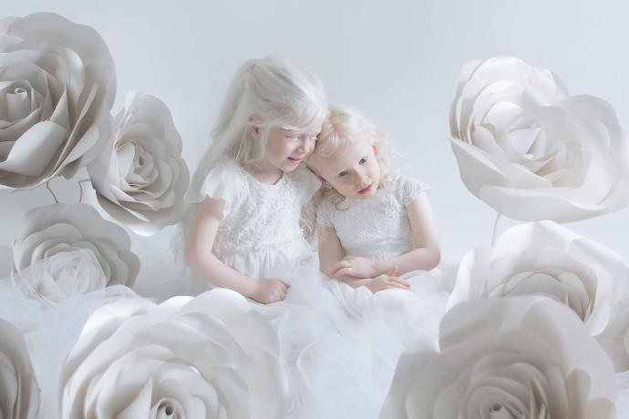 Farklılıkların Eşsiz Olduğunu İspat Eden Albino Modeller