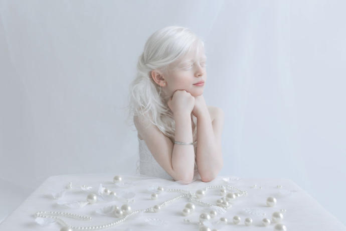 Farklılıkların Eşsiz Olduğunu İspat Eden Albino Modeller