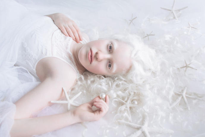 Farklılıkların Eşsiz Olduğunu İspat Eden Albino Modeller