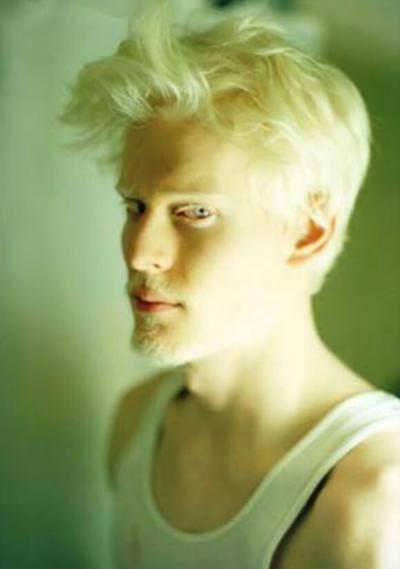 Farklılıkların Eşsiz Olduğunu İspat Eden Albino Modeller