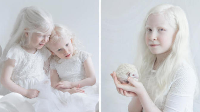 Farklılıkların Eşsiz Olduğunu İspat Eden Albino Modeller