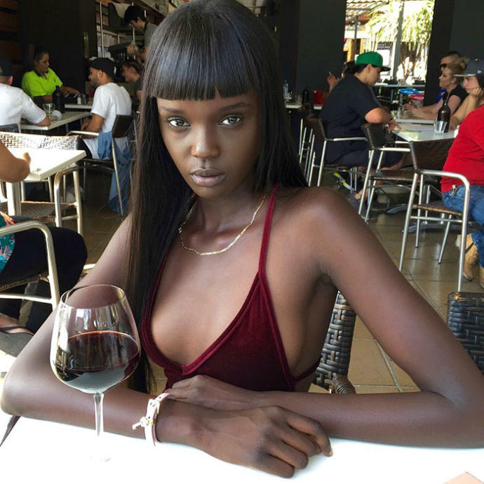 Ten Rengi Yüzünden Zorbalığa Maruz Kalan, Şimdiyse Güzelliğiyle Nam Salmış Model: Duckie Thot!