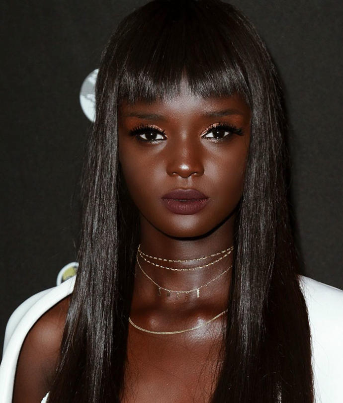 Ten Rengi Yüzünden Zorbalığa Maruz Kalan, Şimdiyse Güzelliğiyle Nam Salmış Model: Duckie Thot!