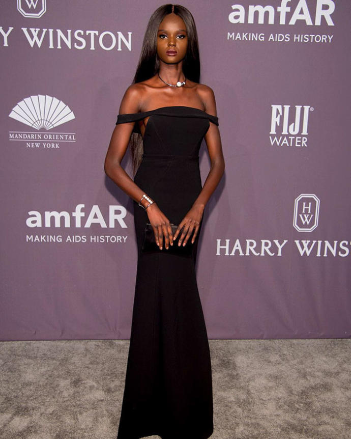 Ten Rengi Yüzünden Zorbalığa Maruz Kalan, Şimdiyse Güzelliğiyle Nam Salmış Model: Duckie Thot!