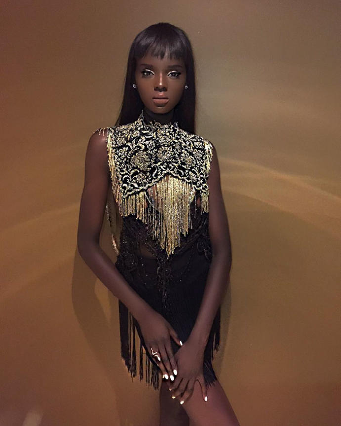 Ten Rengi Yüzünden Zorbalığa Maruz Kalan, Şimdiyse Güzelliğiyle Nam Salmış Model: Duckie Thot!