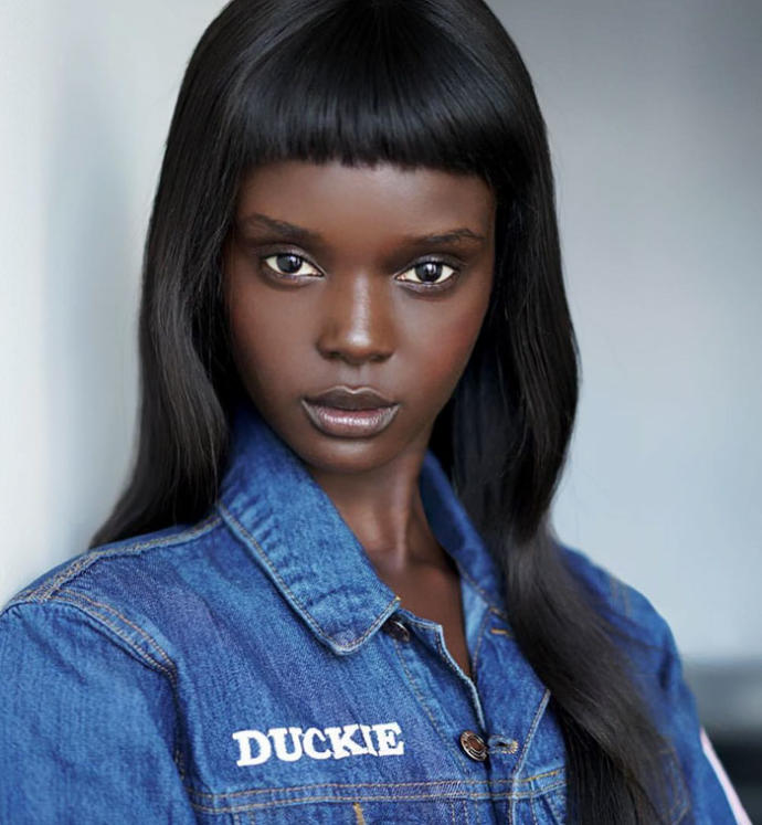 Ten Rengi Yüzünden Zorbalığa Maruz Kalan, Şimdiyse Güzelliğiyle Nam Salmış Model: Duckie Thot!