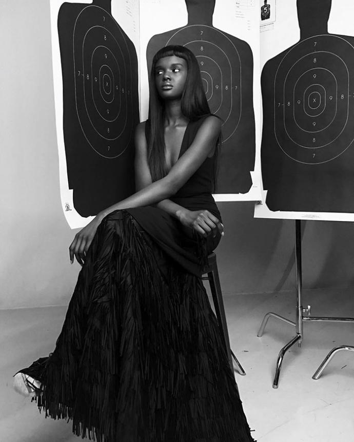 Ten Rengi Yüzünden Zorbalığa Maruz Kalan, Şimdiyse Güzelliğiyle Nam Salmış Model: Duckie Thot!