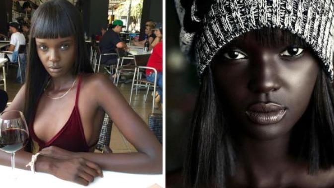 Ten Rengi Yüzünden Zorbalığa Maruz Kalan, Şimdiyse Güzelliğiyle Nam Salmış Model: Duckie Thot!