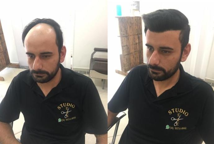 Saçlarınızda Radikal Bir Değişime Gitmeden Önce İncelemeniz Gereken Before & After Paylaşımlar!